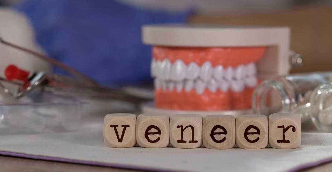 From Science to Smiles: Understanding Veneers